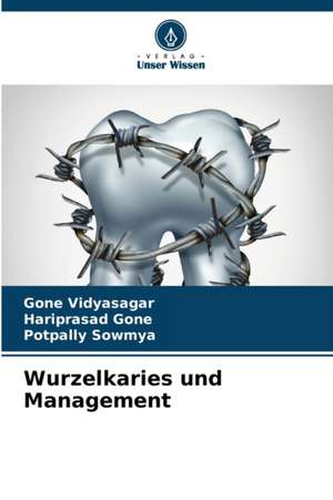 Wurzelkaries und Management de Gone Vidyasagar