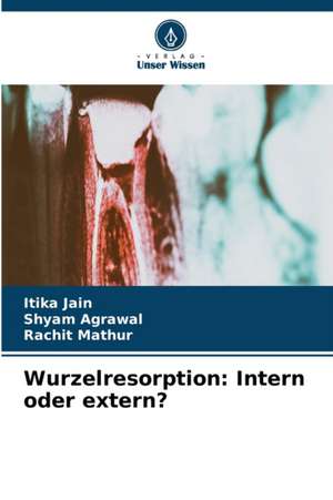 Wurzelresorption: Intern oder extern? de Itika Jain