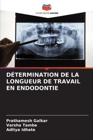 DÉTERMINATION DE LA LONGUEUR DE TRAVAIL EN ENDODONTIE de Prathamesh Galkar