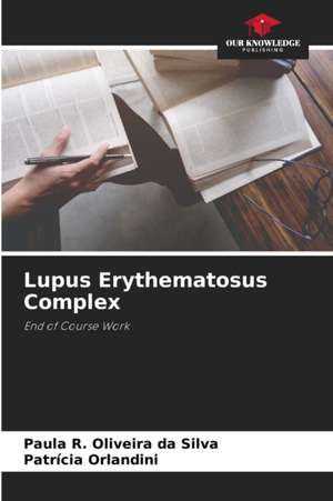 Lupus Erythematosus Complex de Paula R. Oliveira Da Silva