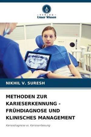 METHODEN ZUR KARIESERKENNUNG - FRÜHDIAGNOSE UND KLINISCHES MANAGEMENT de Nikhil V. Suresh