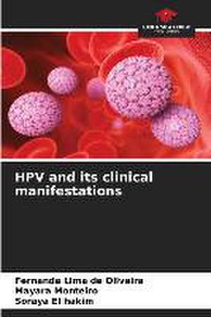 HPV and its clinical manifestations de Fernanda Lima de Oliveira