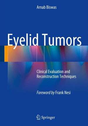 Eyelid Tumors: Clinical Evaluation and Reconstruction Techniques de Arnab Biswas