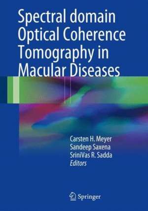 Spectral Domain Optical Coherence Tomography in Macular Diseases de Carsten H. Meyer