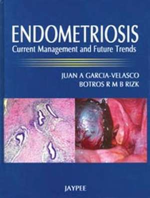 Endometriosis: Current Management and Future Trends de Juan A Garcia-Velasco