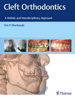 Cleft Orthodontics de Om P Kharbanda