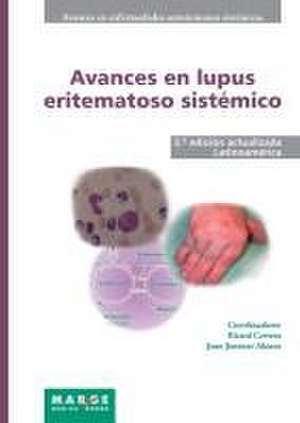 Avances en lupus eritematoso sistémico - Latinoamérica de Juan Jiménez Alonso