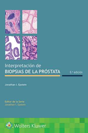 Interpretación de biopsias de la próstata de Jonathan I. Epstein MD