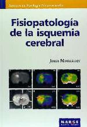 Fisiopatología de la isquemia cerebral de Joan Montaner