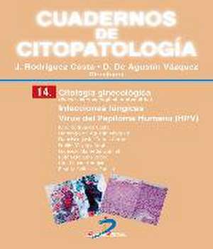 Citología ginecológica : infecciones fúngicas : virus del papiloma humano (HPV) de Domingo De Agustín Vázquez