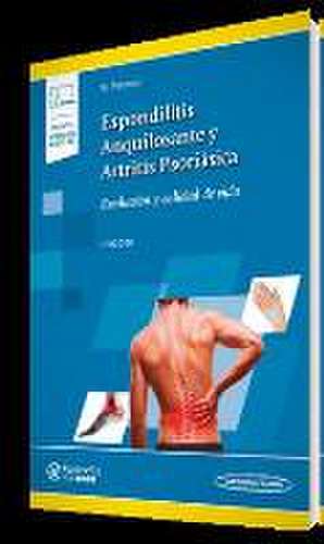 Espondilitis anquilosantes y artritis psoriásica : evolución y calidad de vida de Natalia Palmou Fontana