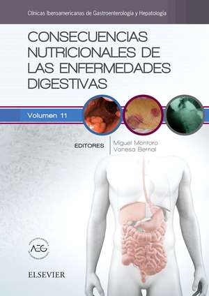 Consecuencias nutricionales de las enfermedades digestivas : clínicas iberoamericanas de gastroenterología y hepatología 11 de Miguel Ángel Montoro Huguet