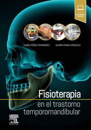 Fisioterapia en el trastorno temporomandibular de Tomás Pérez Fernández