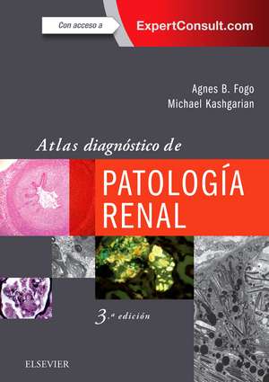 Atlas diagnóstico de patología renal de Agnes B. Fogo