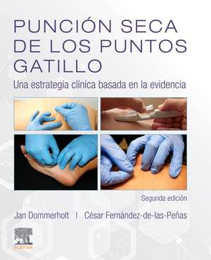 Punción seca de los puntos gatillo de Jan Dommerholt