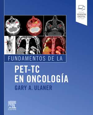 Fundamentos de la PET-TC en oncología de Gary A. Ulaner