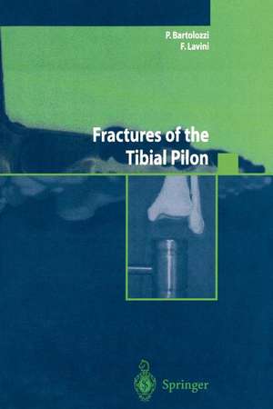 Fractures of the Tibial Pilon de P. Bartolozzi