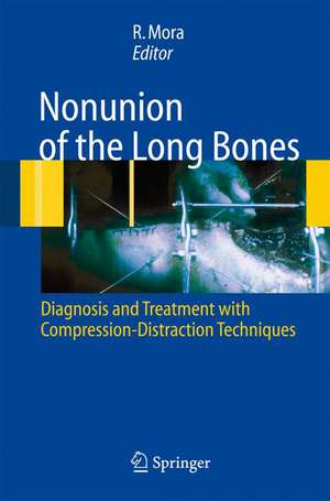 Nonunion of the Long Bones: Diagnosis and treatment with compression-distraction techniques de Redento Mora