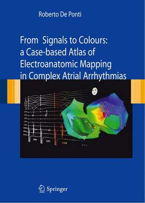 From Signals to Colours: A Case-based Atlas of Electroanatomic Mapping in Complex Atrial arrhythmias de Roberto De Ponti