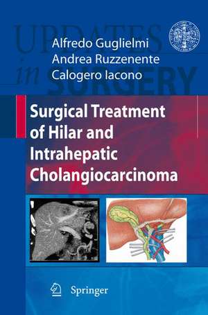 Surgical Treatment of Hilar and Intrahepatic Cholangiocarcinoma de Alfredo Guglielmi