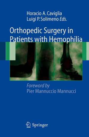 Orthopedic Surgery in Patients with Hemophilia de Horacio A. Caviglia