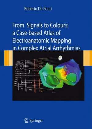 From Signals to Colours: A Case-based Atlas of Electroanatomic Mapping in Complex Atrial arrhythmias de Roberto De Ponti