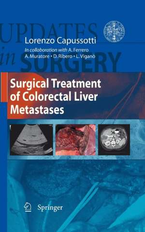 Surgical Treatment of Colorectal Liver Metastases de Lorenzo Capussotti