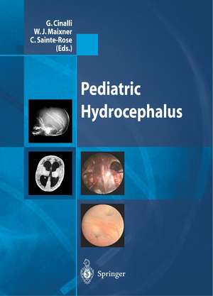 Pediatric Hydrocephalus de G. Cinalli