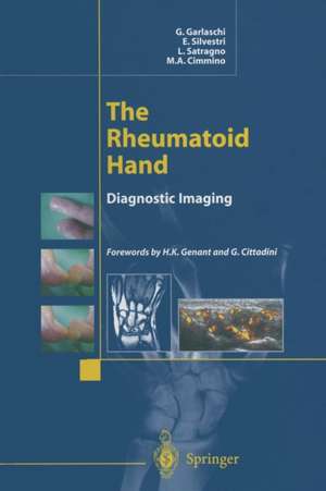 The Rheumatoid Hand: Diagnostic Imaging de G. Garlaschi