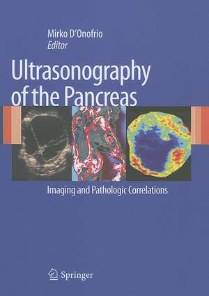 Ultrasonography of the Pancreas: Imaging and Pathologic Correlations de Mirko D'Onofrio