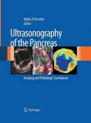 Ultrasonography of the Pancreas: Imaging and Pathologic Correlations de Mirko D'Onofrio