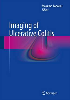 Imaging of Ulcerative Colitis de Massimo Tonolini