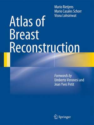 Atlas of Breast Reconstruction de Mario Rietjens