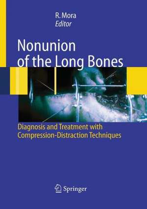 Nonunion of the Long Bones: Diagnosis and treatment with compression-distraction techniques de Redento Mora