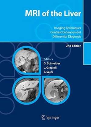 MRI of the Liver: Imaging Techniques, Contrast Enhancement, Differential Diagnosis de Günther Schneider