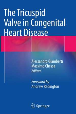 The Tricuspid Valve in Congenital Heart Disease de Alessandro Giamberti