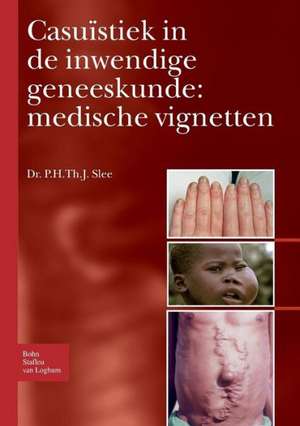 Casuïstiek in de inwendige geneeskunde: medische vignetten de P. H. Th. J. Slee