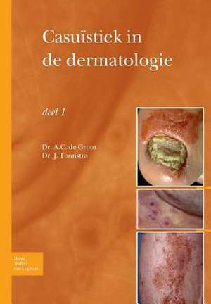 Casuïstiek in de dermatologie - deel I de Anton C. Groot