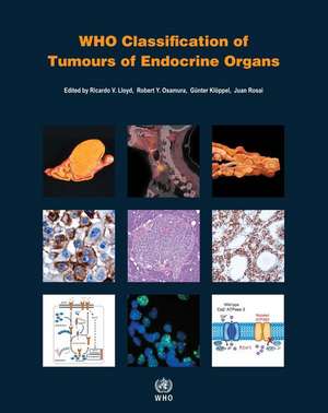 Who Classification of Tumours of Endocrine Organs de Who Classification of Tumours Editorial Board