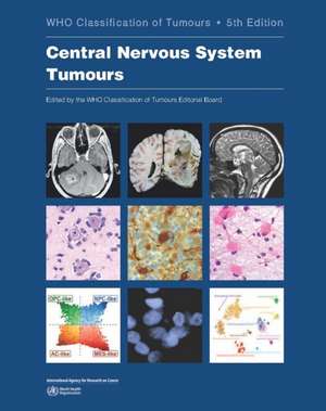 Central Nervous System Tumours de Who Classification of Tumours Editorial Board