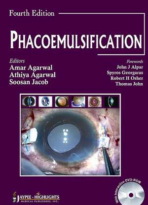 Phacoemulsification, Fourth Edition