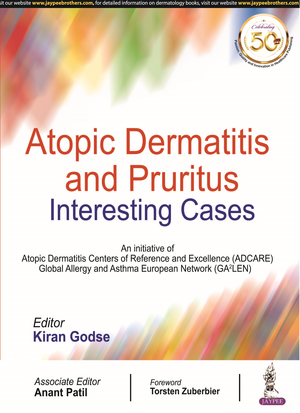 Atopic Dermatitis and Pruritus: Interesting Cases de Kiran Godse