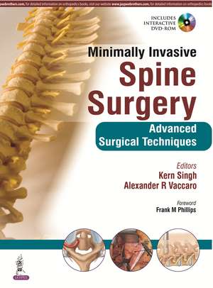 Minimally Invasive Spine Surgery de Kern Singh