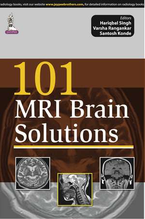 101 MRI Brain Solutions de Hariqbal Singh