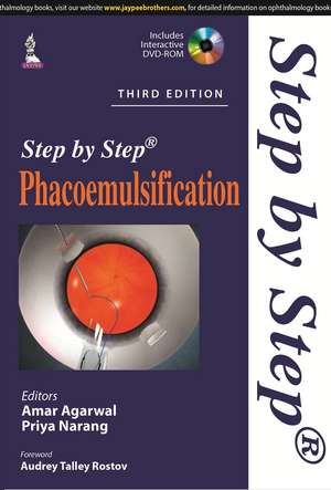 Step by Step Phacoemulsification de Amar Agarwal