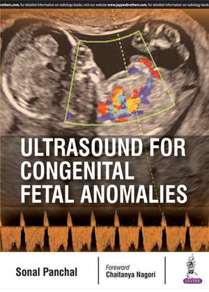 Ultrasound for Congenital Fetal Anomalies de Sonal Panchal