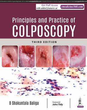 Principles and Practice of Colposcopy de B Shakuntala Baliga