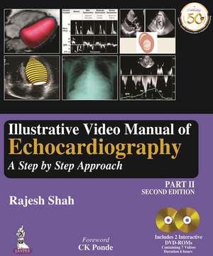 Illustrative Video Manual of Echocardiography Part 2: A Step by Step Approach de Rajesh Shah