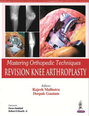 Mastering Orthopedic Techniques: Revision Knee Arthroplasty de Rajesh Malhotra