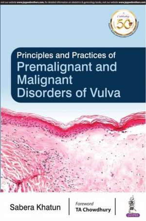 Principles and Practice of Premalignant and Malignant Disorders of Vulva de Sabera Khatun